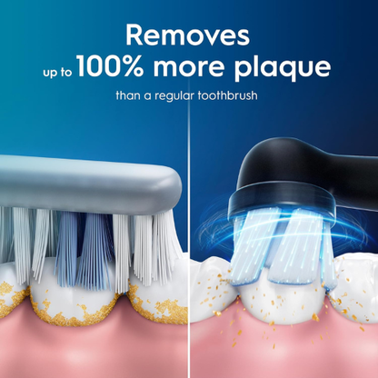 Electric Toothbrush – iO2 Model for Gentle & Effective Plaque Removal