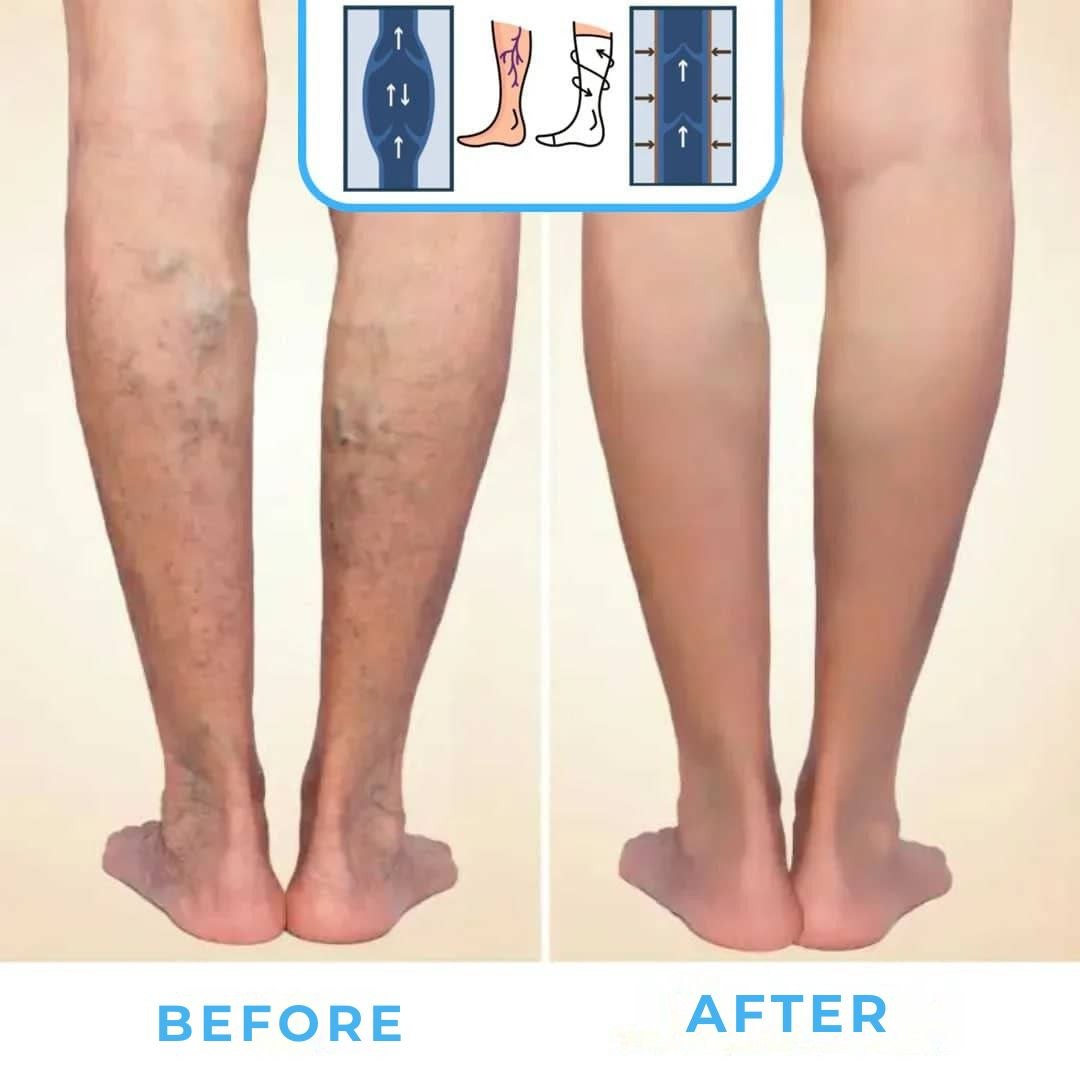 FlowSocks™ - Support socks